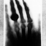 first-xray